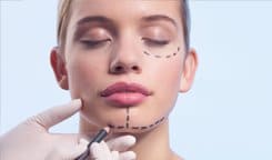Chin reduction surgery in Gurgaon